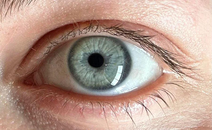 ways to describe blue eyes